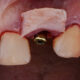 Tissue Grafting in Implantology (4 days)