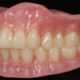 Digital Complete Dentures (3 days)